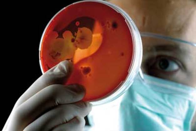 Lässt unnützen Mikroben keine Chance